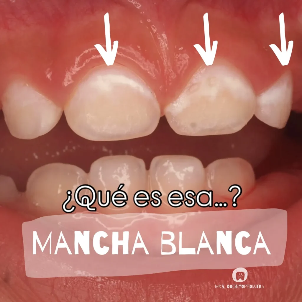 instagram feed odontopediatria valencia 3